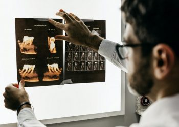 Sehabis Kurban Timbul Sakit Gigi, Berikut Pilihan Alternatif Obatnya