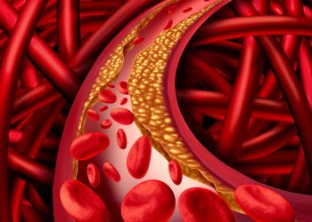 Yuk, Cek Batasan Kolesterol Sebelum Santap Daging Kurban