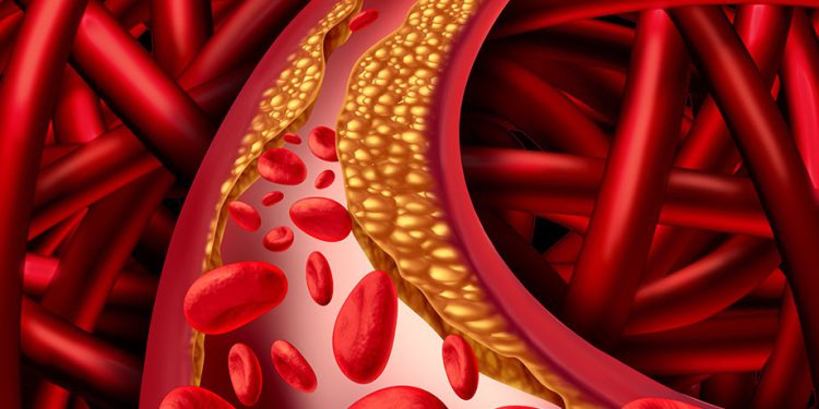 Dalam tubuh kita, kolesterol memiliki tiga peran penting, yaitu sebagai komponen utama dari membran dan struktur yang bermanfaat untuk membangun jaringan tubuh, membantu organ hati dalam menghasilkan asam empedu serta membantu dalam produksi hormon seks. Selain itu, kolesterol juga bermanfaat untuk membantu perkembangan otak anak. Itulah mengapa kita membutuhkan asupan kolesterol. Foto: LINES.